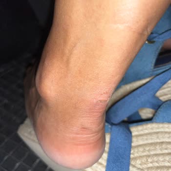 Zara Dolgu Topuk Jean Kumaş Ayakkabı