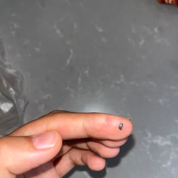 Güler Sucuğun İçinden Metal Parça