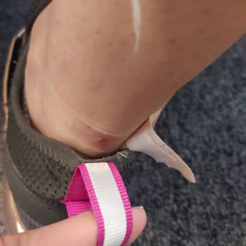 Decathlon Ayakkabıdaki Rahatsızlık