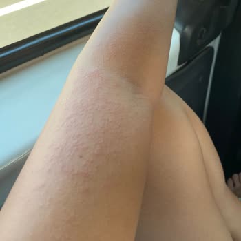 Eda Taşpınar Bombanın Hayal Kırıklığı