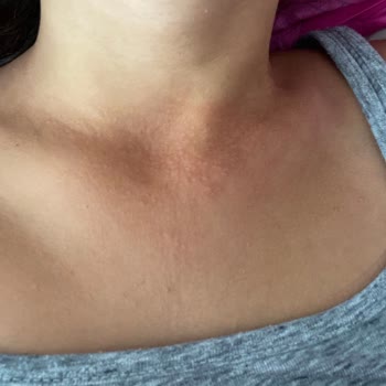 Eda Taşpınar Bombanın Hayal Kırıklığı