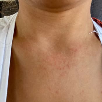 Eda Taşpınar Bombanın Hayal Kırıklığı