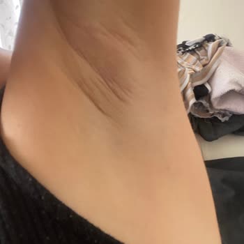 Nivea Double Effect Roll-on Deodorant Koltuk Altında Tahriş Yaptı