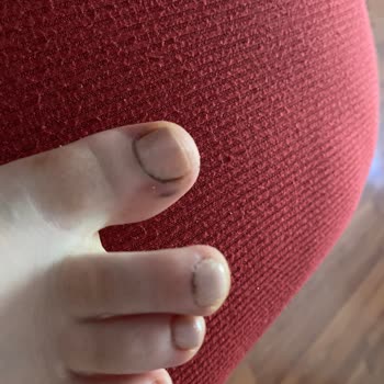 Zeynep Çam Güzellik Ve Bakım Pedikür Faciası!