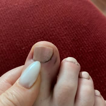 Zeynep Çam Güzellik Ve Bakım Pedikür Faciası!