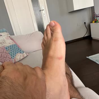 Skechers Terliğin Ayağıma Vurması.