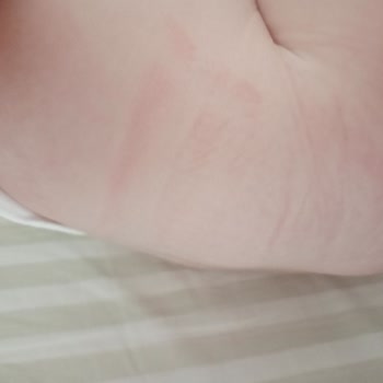 Molfix Bebek Bezi Boşa Giden Para