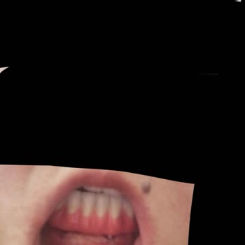 Canpol Dental Clinic Tehdit Edilme Ve Sözünde Durmayan