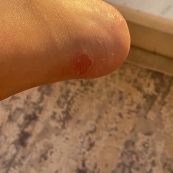 Vakko Babet Kötü Ve Rahatsız