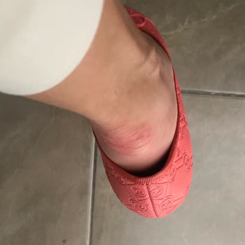 Vakko Babet Kötü Ve Rahatsız