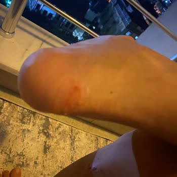 Vakko Babet Kötü Ve Rahatsız