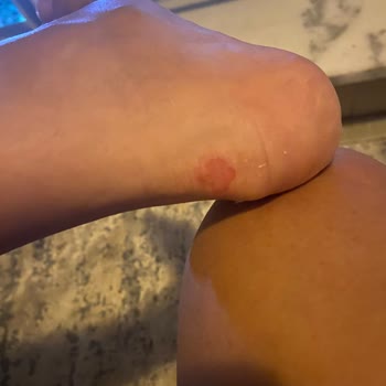 Vakko Babet Kötü Ve Rahatsız