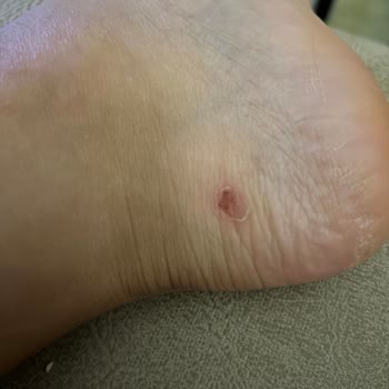 Lacoste Ayakkabı Hatalı Ürün