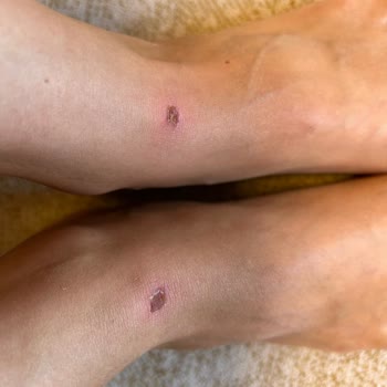 Lacoste Ayakkabı Hatalı Ürün