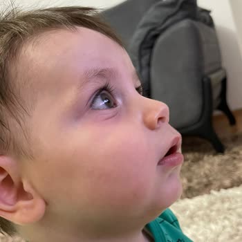 Mustela Güneş Kremi Alerji!
