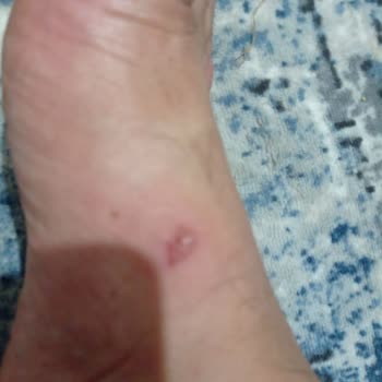FLO Ayakkabı FLO Mağazasından Almış Olduğum Polo Terlik Ayağımı Yara Yaptı.