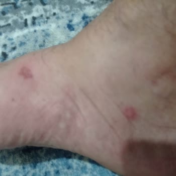 FLO Ayakkabı FLO Mağazasından Almış Olduğum Polo Terlik Ayağımı Yara Yaptı.
