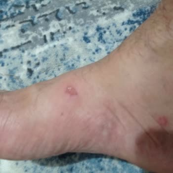 FLO Ayakkabı FLO Mağazasından Almış Olduğum Polo Terlik Ayağımı Yara Yaptı.