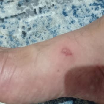 FLO Ayakkabı FLO Mağazasından Almış Olduğum Polo Terlik Ayağımı Yara Yaptı.