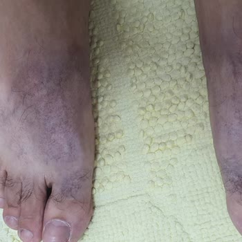 FLO Ayakkabı FLO Dan Ürün Alırken Dikkat İnanılmaz Hijyen Problemi!