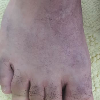 FLO Ayakkabı FLO Dan Ürün Alırken Dikkat İnanılmaz Hijyen Problemi!