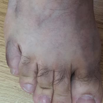 FLO Ayakkabı FLO Dan Ürün Alırken Dikkat İnanılmaz Hijyen Problemi!