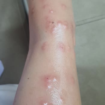 Kappa Tur Yüzünden Sağlığımdan Oldum.