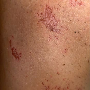 Derby Lady Tüy Dökmüyor Deriyi Mahvediyor