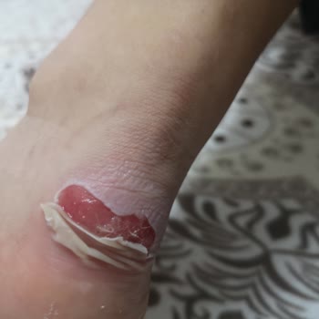 FLO Ayakkabı Ayaklarımı Maf Etti