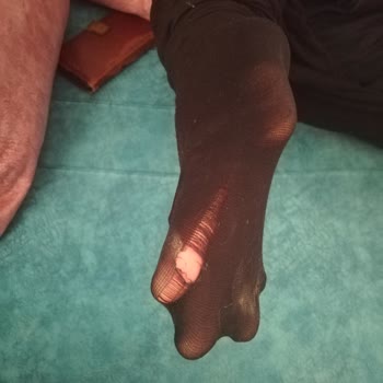 Penti Çorabın 2 Kere Giyimde Yırtılması