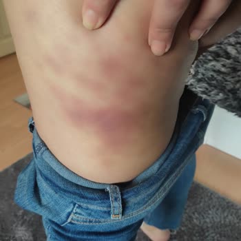 Sevgi Medlife Estetik'te Haksız Kazanç Ve İşlerini Yapamamaları