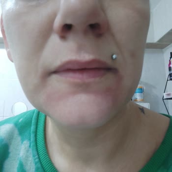 Sevgi Medlife Estetik'te Haksız Kazanç Ve İşlerini Yapamamaları