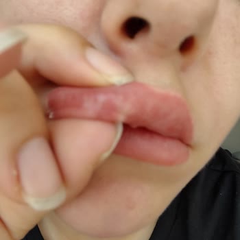 Doğuş Clinical Clinic Değil Güzellik Salonu İnsan Sağlığıyla Oynuyorlar!