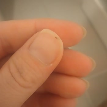 Hünkar Bakliyat Böceklenme Sorunu