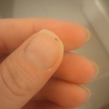 Hünkar Bakliyat Böceklenme Sorunu