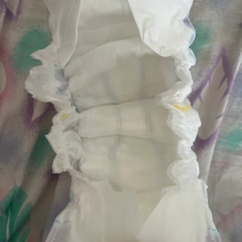 Molfix Bebek Bezi İle İlgili Şikayet