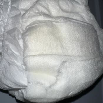Migros Minies Bebek Bezi - Külot Bez İçindeki Batıcı Sivri Cisim
