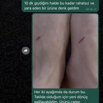 Zara Aldığım Ürünün Her İki Ayağımı Yara Yapması