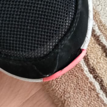 Skechers Bu Problem Senin, Çözmelisin!