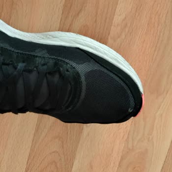 Skechers Bu Problem Senin, Çözmelisin!