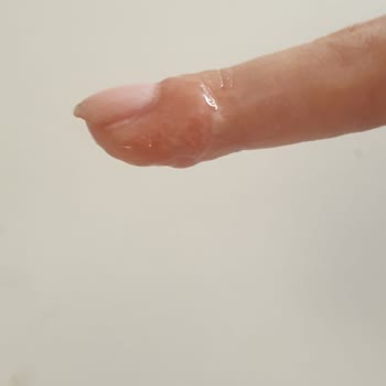 Cansın Sağlık Gereçleri Alerji Yapan Yarabandı