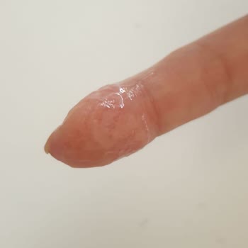 Cansın Sağlık Gereçleri Alerji Yapan Yarabandı