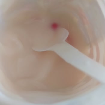 Danone Tikveşli Yoğurtta Problem