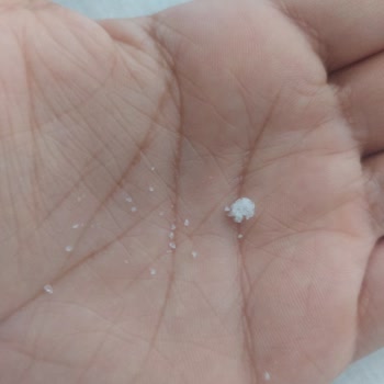 Molfix 4 Numara Bebek Bezi Sert Küçük Toplar Var