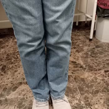 H&M Ürün Kalitesizliği -Pantolon Diz Yapma