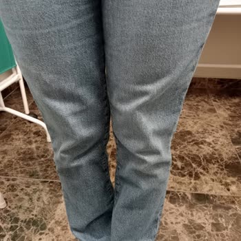 H&M Ürün Kalitesizliği -Pantolon Diz Yapma