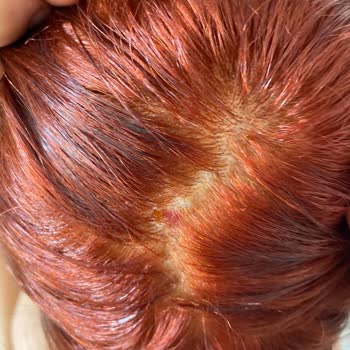 Palette Kafa Derimi Yaktı