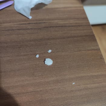 Eti Gıda Eti Wanted Çikolatada Yabancı Madde