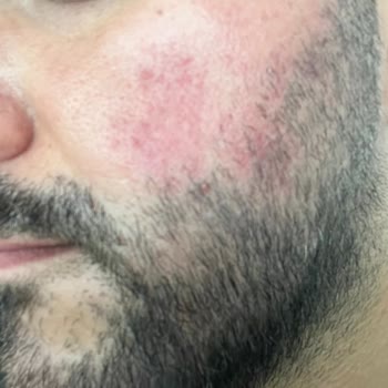 Anadolu Hastanesi (Silivri, Avcılar, Ereğli) Yanlış Tedavi