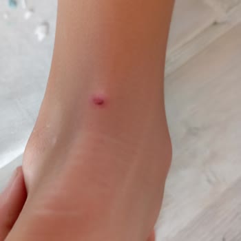 LCW Ayakkabı Ayağı Yara Yapıyor